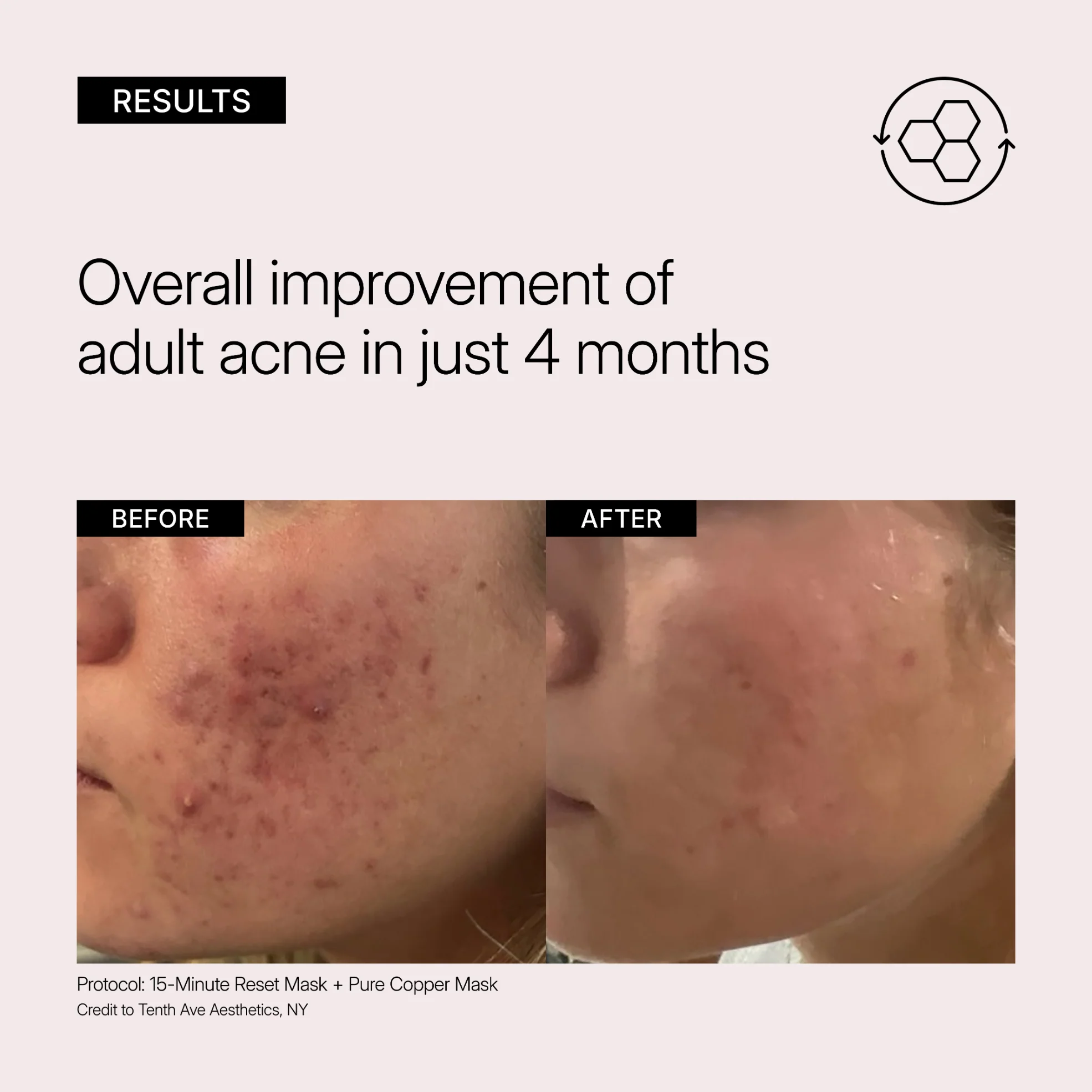 15-Minute Reset Mask - Image 4