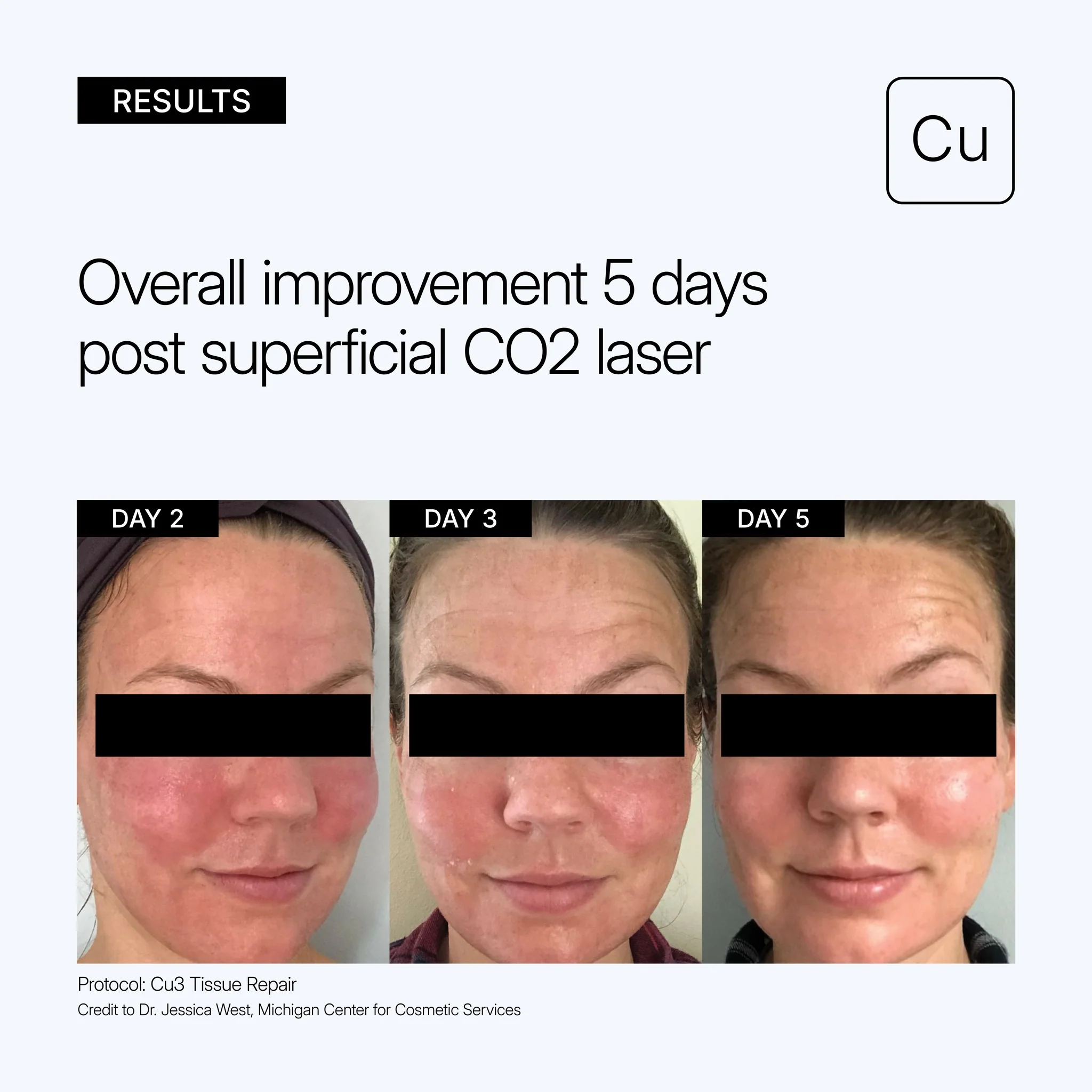 Cu3 Tissue Repair - Image 3
