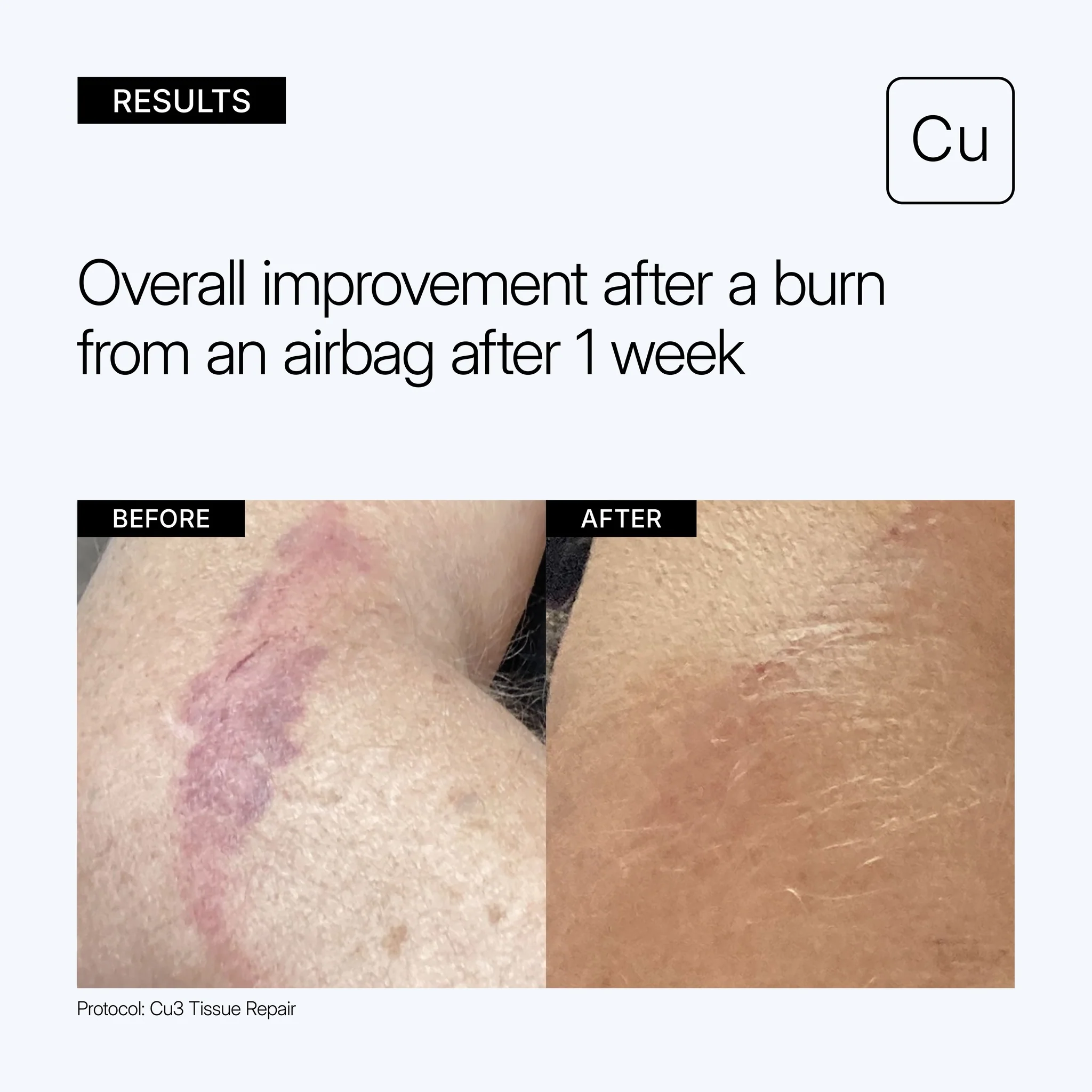 Cu3 Tissue Repair - Image 6